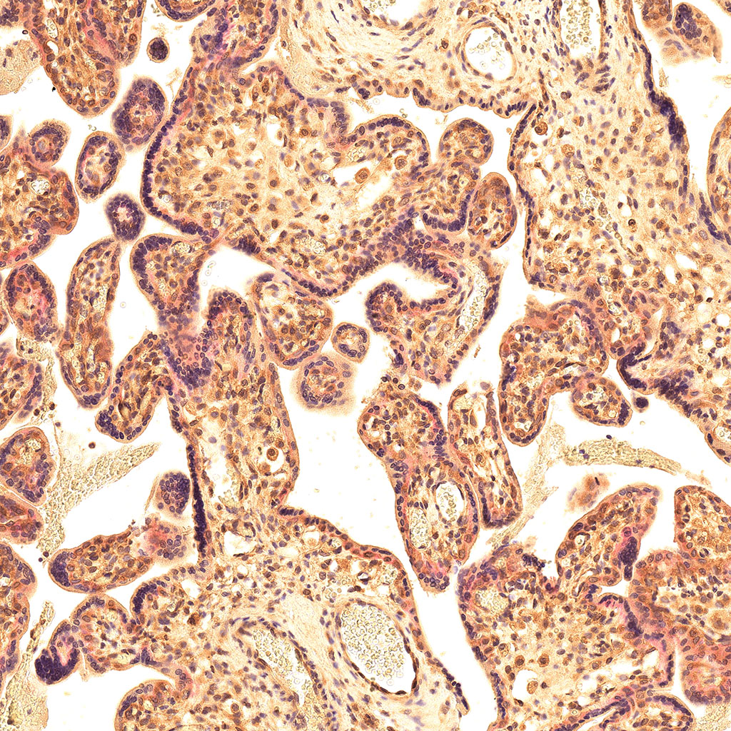 sars-cov-2 gene expression in a human fetus